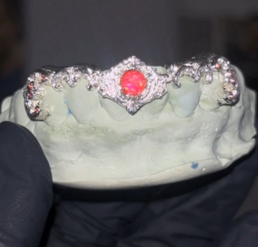 Luxury Grillz